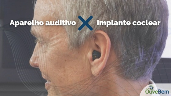 Aparelho auditivo x implante coclear