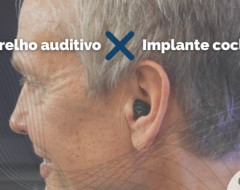 Aparelho auditivo x implante coclear